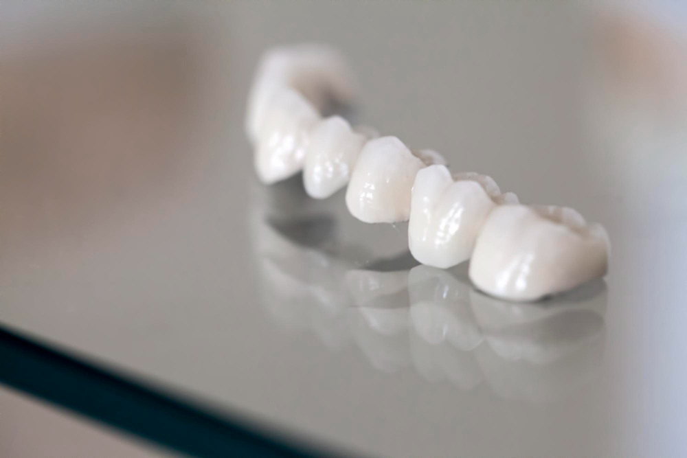 Dental Crowns in Bedford